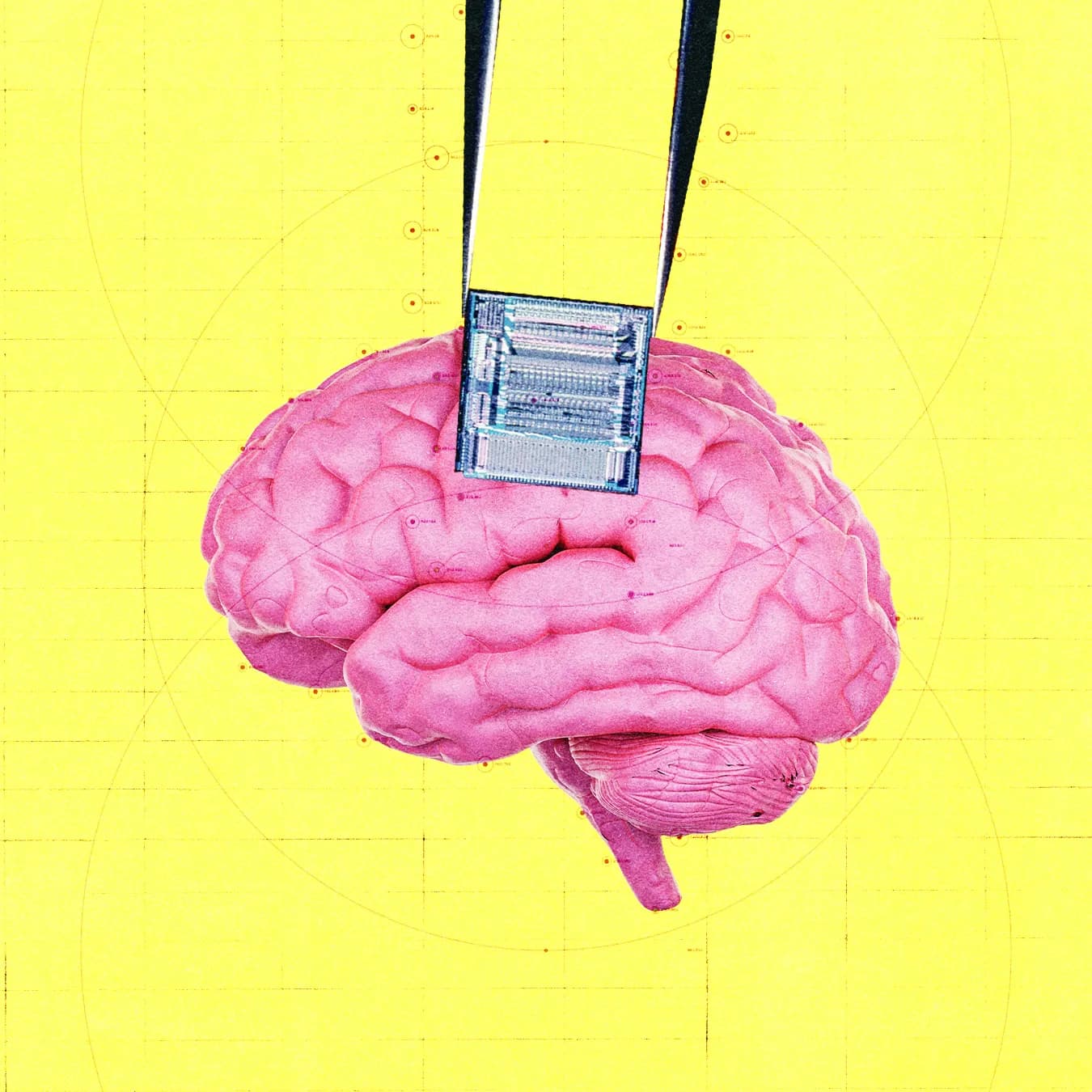 OpenAI Backs Startup Developing Brain Implants for Cancer Detection
