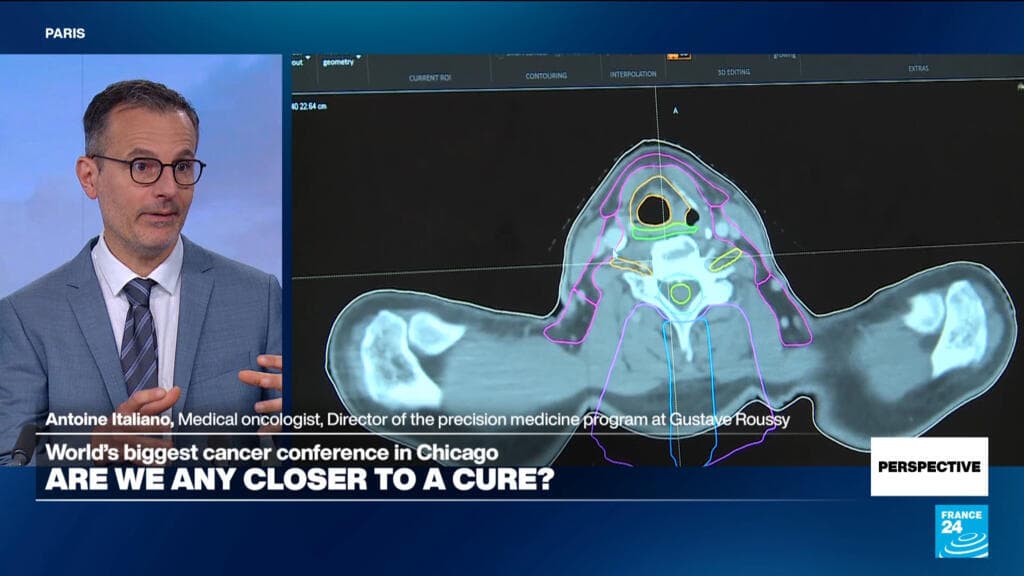 Leading Oncologist Advocates for Enhanced Cancer Prevention Efforts