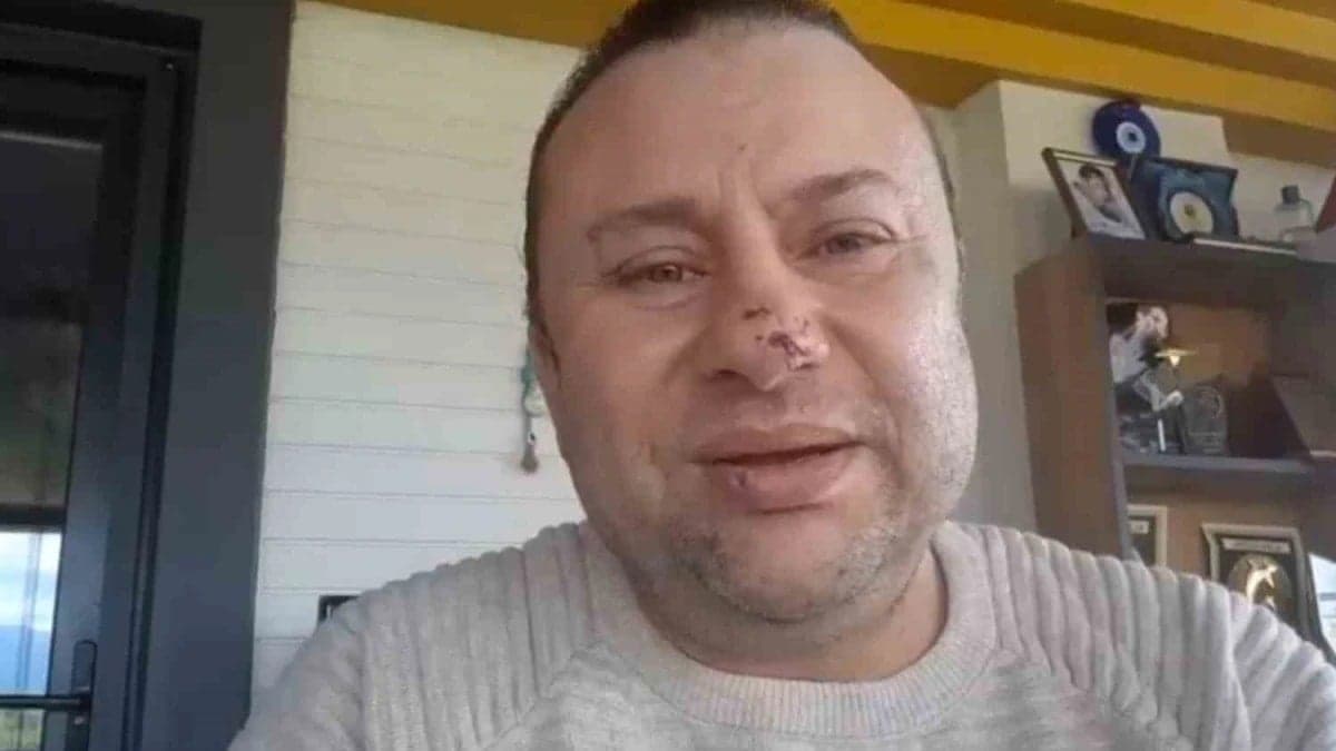 Pitbull saldırısında et yiyen bakteri bulaştı: İşte Onur Akay'ın son durumu