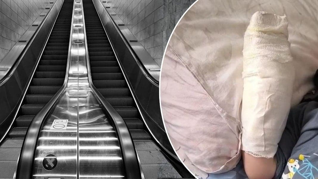 AVM'de yürüyen merdiven faciası; 3 yaşındaki çocuğun kopan parmağı kurtarılamadı