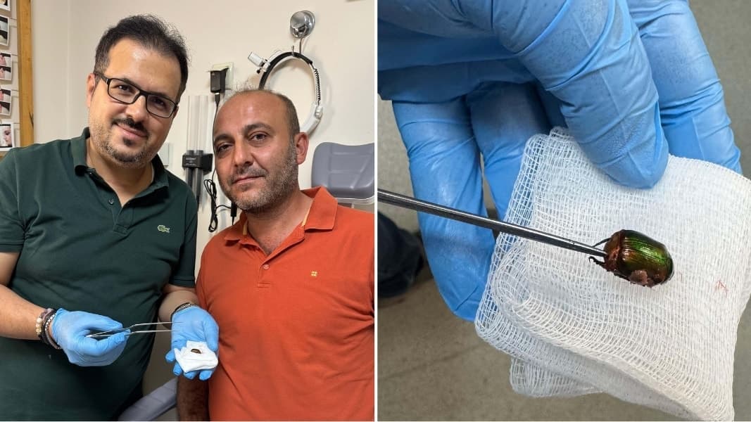 Hastaneye giden kişinin kulağında böcek bulundu