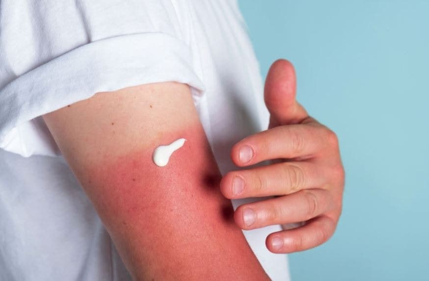 Uzmanlar SPF ve UVA'nın farklarını açıkladı