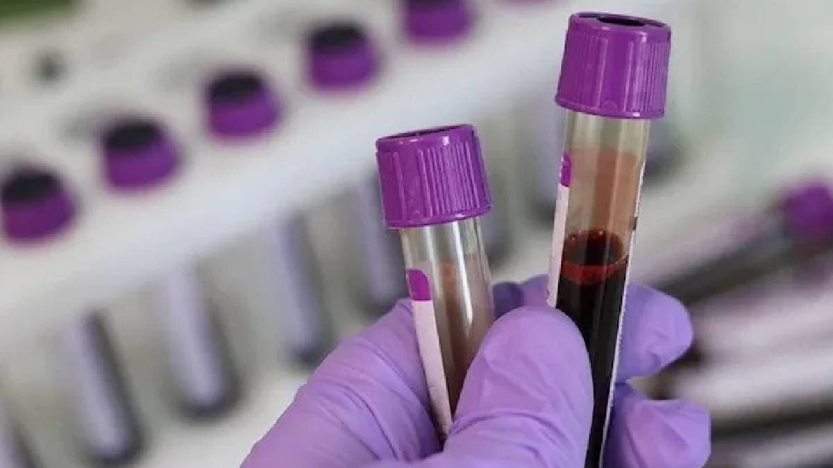 Evrensel kan grubu keşfedildi