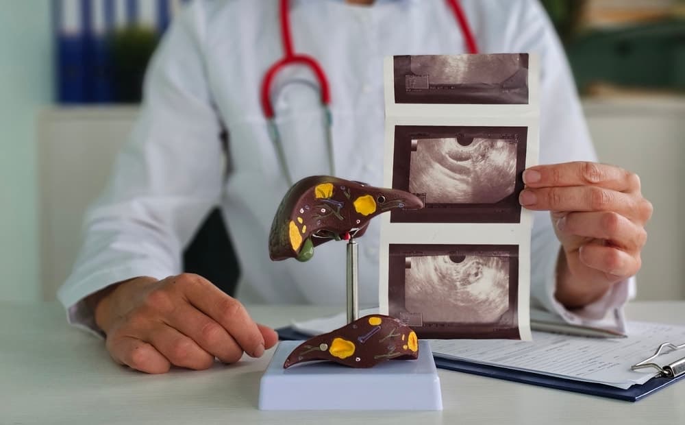 Popüler içeceklerin karaciğere zarar verdiği belirlendi