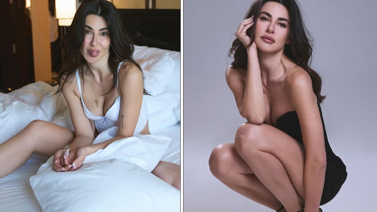 Nesrin Cavadzade, botoks iddialarına yanıt verdi