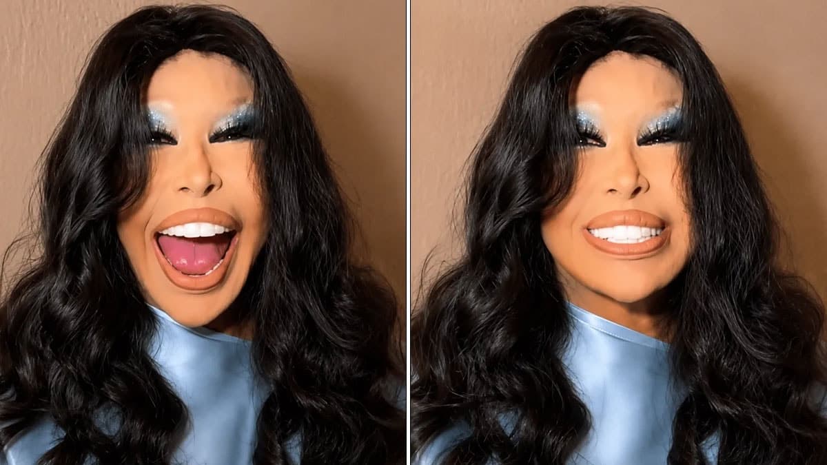 Bülent Ersoy estetik operasyon sonrası ilk kez görüntülendi