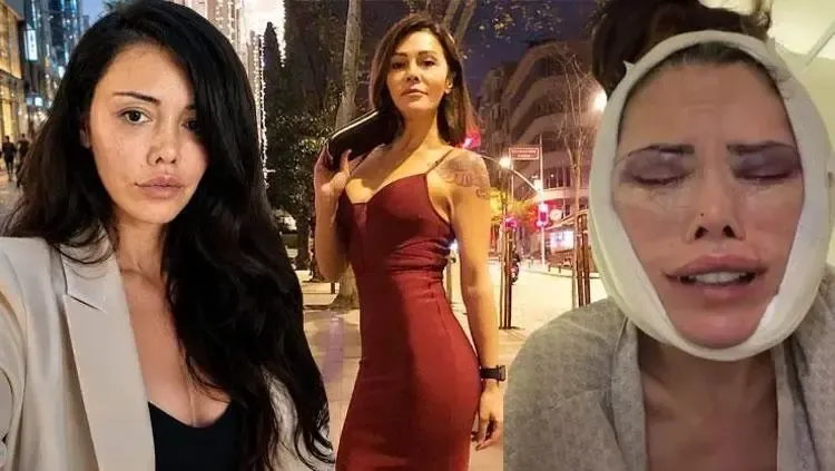 Yüz nakli olan Didem Ceran, yaşadığı zorlukları paylaştı.