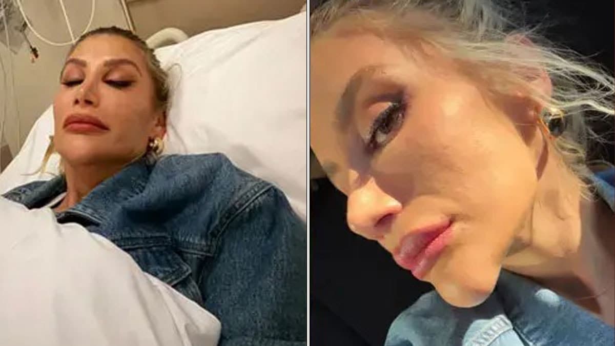 İrem Derici'nin çenesindeki şişlik böcek ısırığından kaynaklanıyor