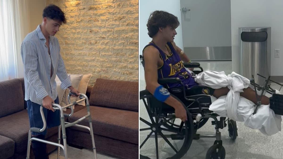 Survivor yarışmacısı bacağını kaybettikten sonra yeni hayatına adapte olmaya çalışıyor