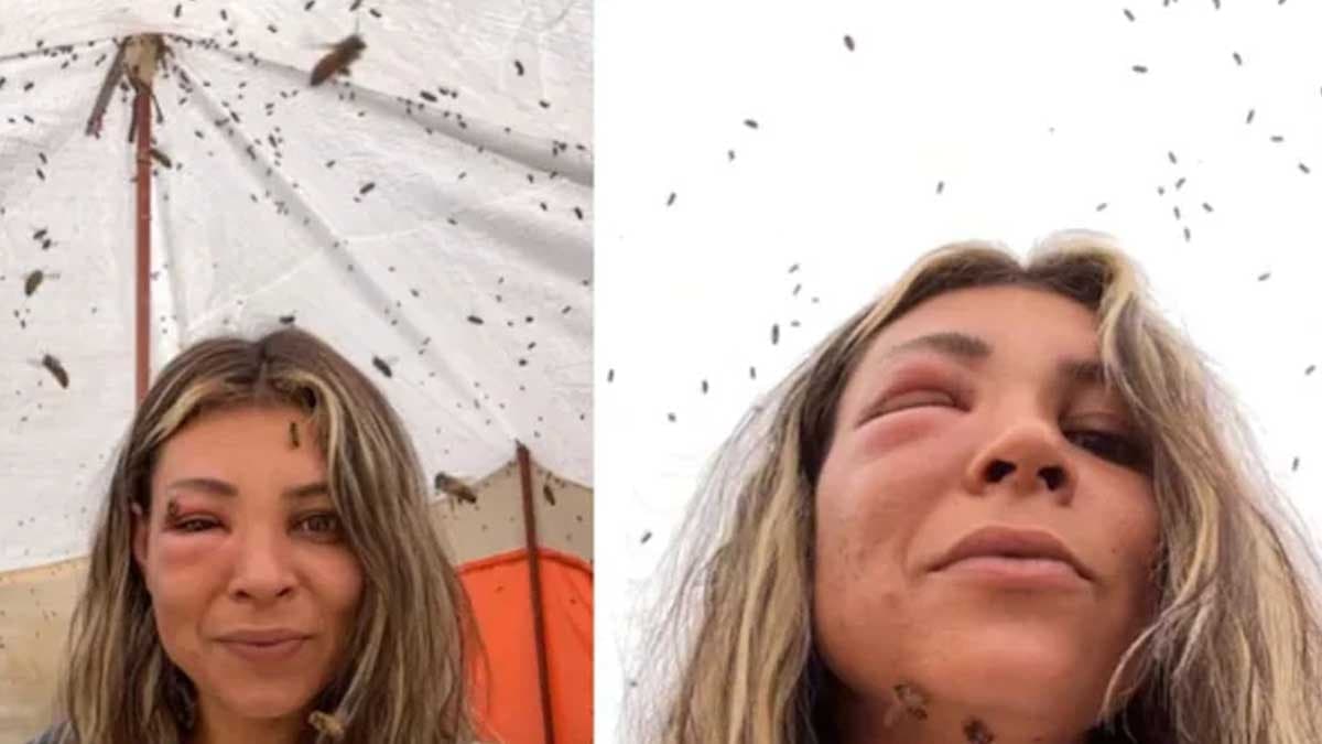 Arıcılık yapan kadın beklenmedik bir saldırıya uğradı