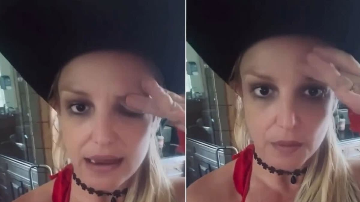 Botoks sonrası gözünde sorun yaşayan Britney Spears durumu anlattı