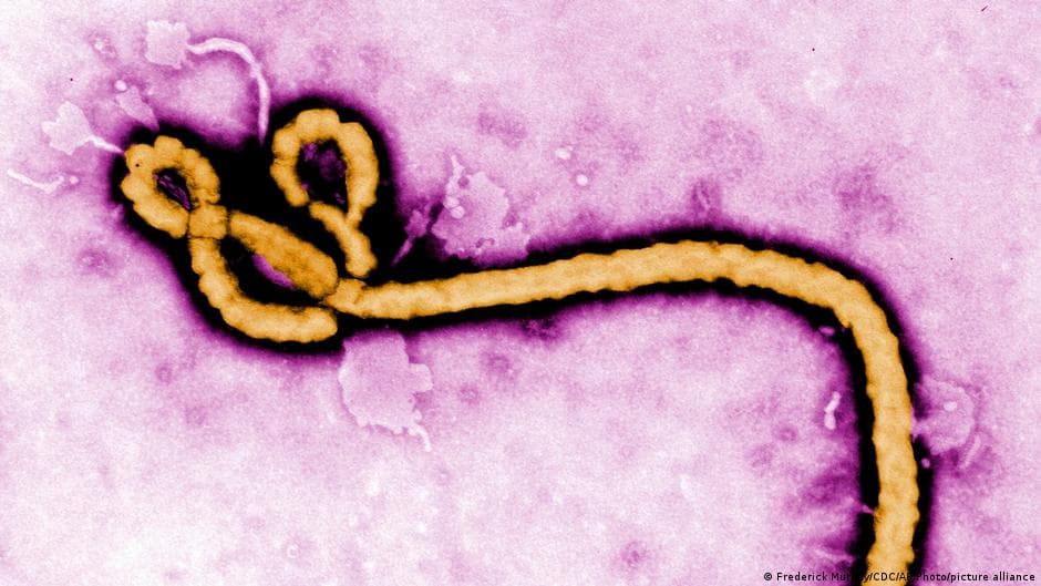 France Confirms First Ebola Case Linked to Congo Outbreak