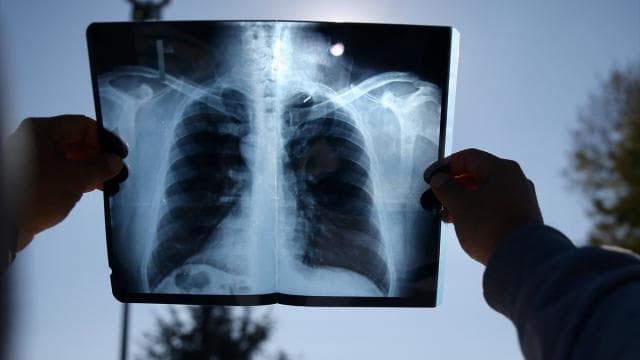 İspanya, 114 yıl aradan sonra tam güneş tutulmasına hazırlanıyor