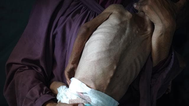 DSÖ: Kongo Demokratik Cumhuriyeti'nde 10 milyon kişi açlık tehlikesiyle karşı karşıya