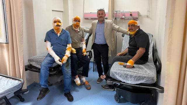 Ordu'da mutfakta patlama: 5 yaralı