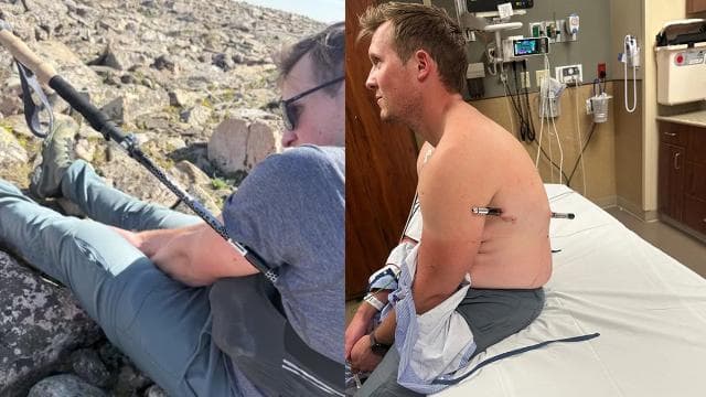 Dağcı, vücuduna saplanan sopayla 16 kilometre yürüyerek kurtuldu