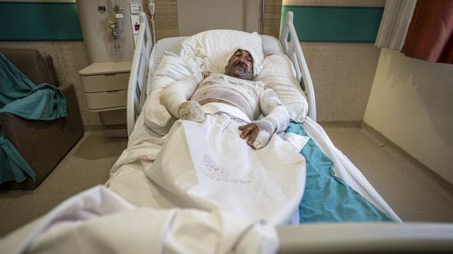 Balkonda benzin sızıntısı sigara ile patladı
